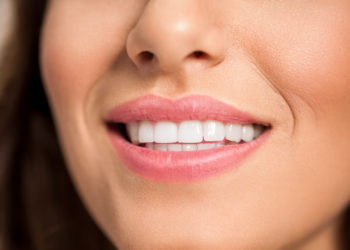 How to Whiten Your Teeth Naturally in Eight Ways