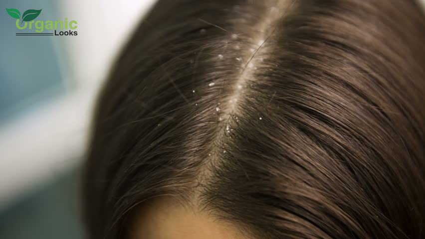 olive oil keeps dandruff at bay