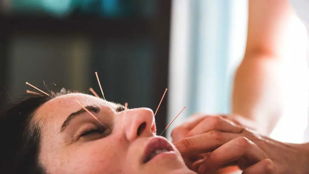 cosmetic acupuncture